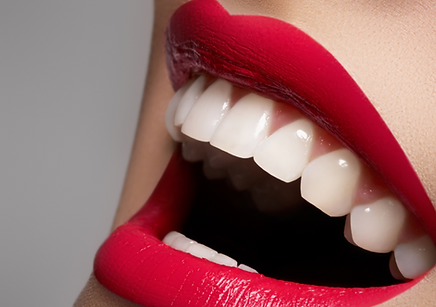 Fort Mill teeth whitening