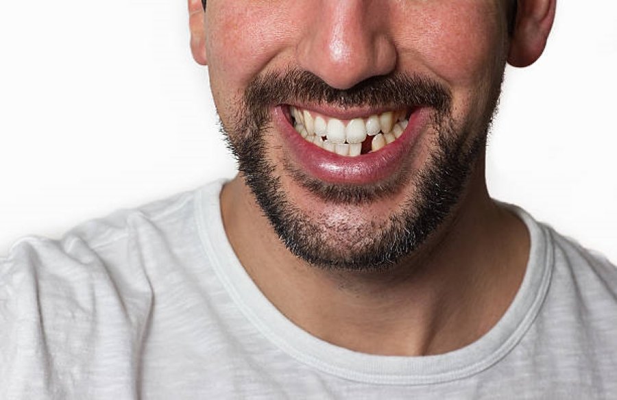 Someone in need of implant dentistry near Charlotte