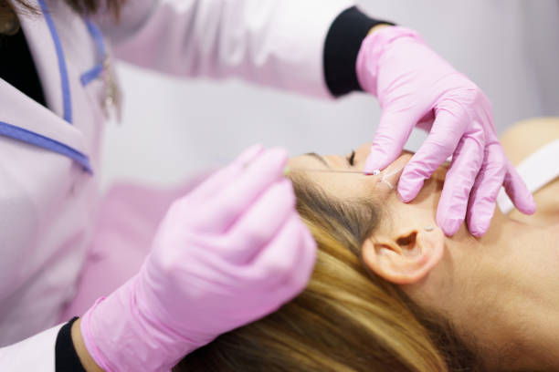 Everything you need to know about PDO thread lift treatments for treating fine lines and wrinkles in Baxter Village, near Fort Mill, SC