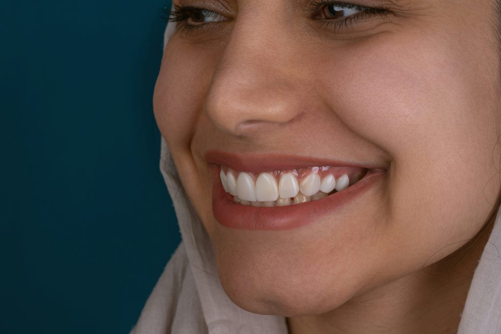 Our teeth-whitening treatment in Fort Mill, SC, brightens teeth safely and effectively